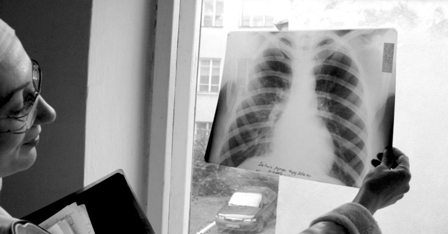 Каждый день в регионе от туберкулеза умирает один человек 